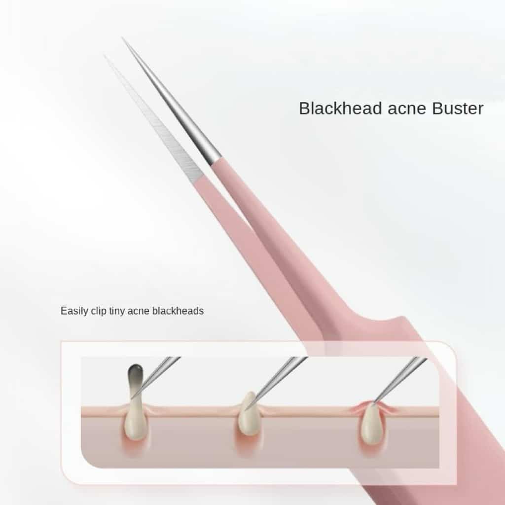 High Quality Stainless Steel Pimple Pore Blackhead Whitehead Acne Needle Extractor Remover .jpg